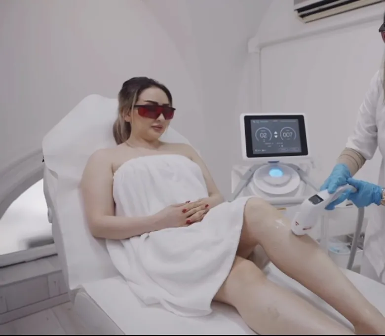Laser hair removal