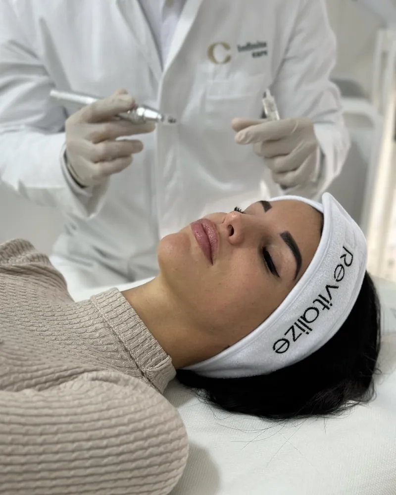 Mesotherapy with micro needles